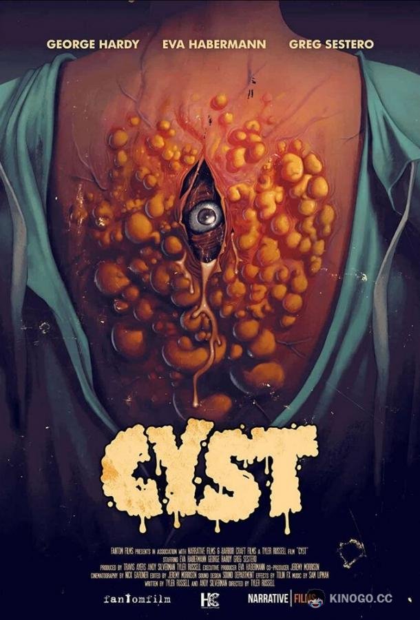Киста Cyst (2020)